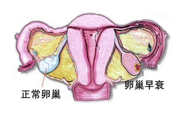 看FSH还不够吗?为什么卵巢早衰还要看AMH?